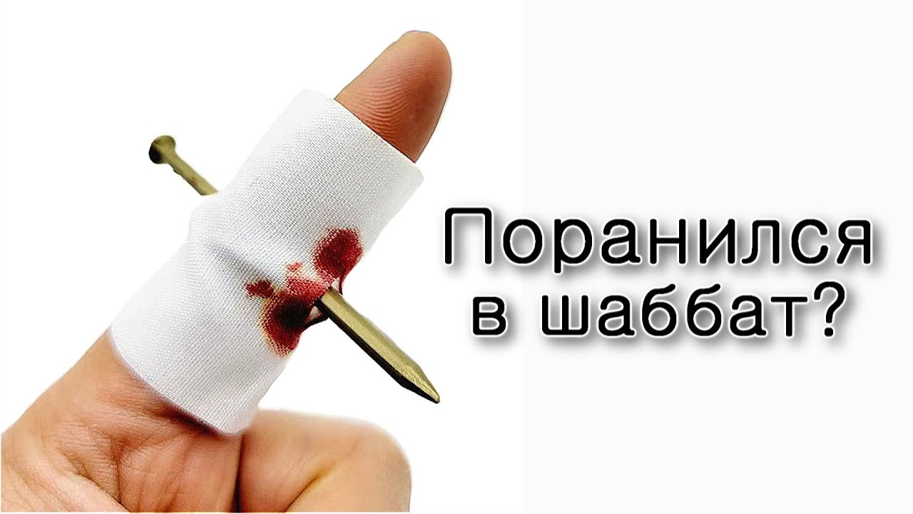 Поранился в шаббат – что делать?